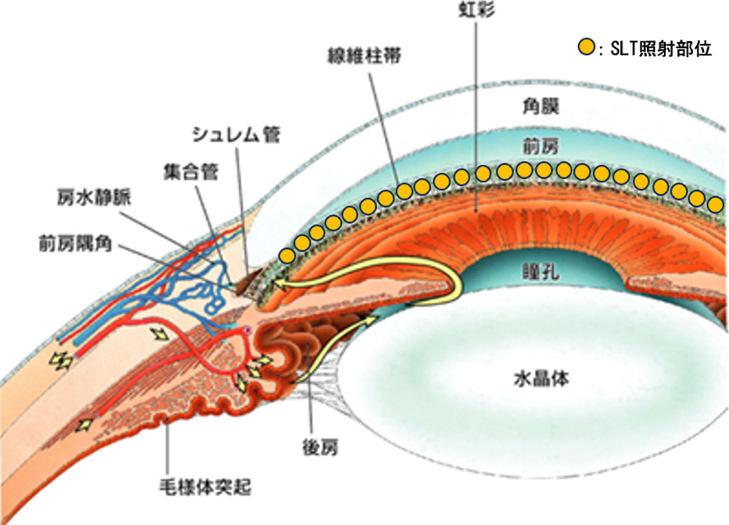 【値引交渉可】All About 開放隅角緑内障 All About 開放隅角緑内障 第2版 | 書籍詳細 | 書籍 | 医学書院